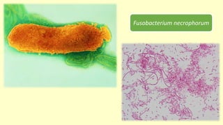 Fusobacterium necrophorum
 