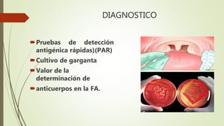 DIAGNOSTICO
Pruebas de detección
antigénica rápidas)(PAR)
Cultivo de garganta
Valor de la
determinación de
anticuerpos en la FA.
 