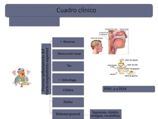 Cuadro clínico
Proceso
inflamatorio
del
tracto
respiratorio
superior
Cefalea
Fiebre
Malestar general
hiporexia, vómito,
mialgias, escalofríos,
HNE: 3-4 DIAS
• Rinorrea
Obstrucciónnasal
Tos
• Odinofagia
 