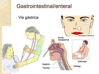 Gastrointestinal/enteral
◦ Via gástrica
 