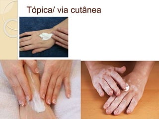 Tópica/ via cutânea
 