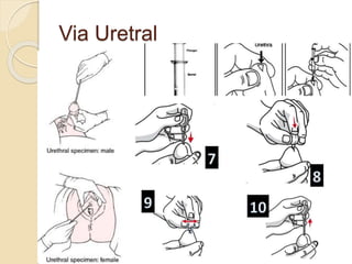 Via Uretral
 