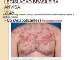 LEGISLAÇÃO BRASILEIRA
ANVISA
VISAPORTARIA N. 344/1998
Estabelece o regulamento técnico sobre substâncias e medicamentos sujeitos a
controle especial
 C5 (Anabolizantes) Metiltestosterona
 
