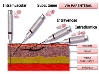VIA PARENTERAL
EPIDERME
DERME
TECIDO
SUBCUTÂNEO
MÚSCULO
 