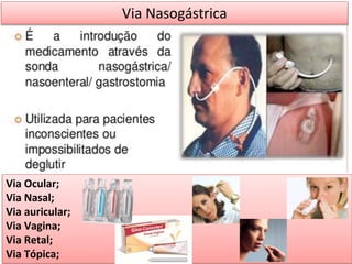 Via Nasogástrica
Via Ocular;
Via Nasal;
Via auricular;
Via Vagina;
Via Retal;
Via Tópica;
 