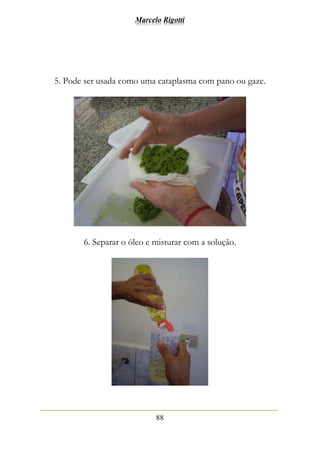 Marcelo Rigotti
88
5. Pode ser usada como uma cataplasma com pano ou gaze.
6. Separar o óleo e misturar com a solução.
 