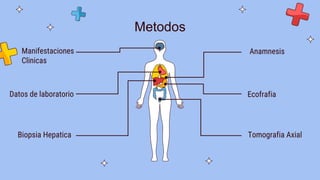 Metodos
Manifestaciones
Clinicas
Datos de laboratorio
Biopsia Hepatica
Anamnesis
Ecofrafia
Tomografia Axial
 