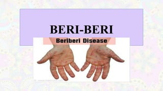 BERI-BERI
 