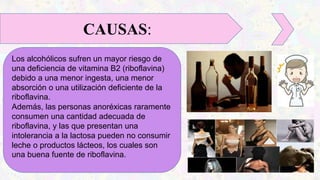 Los alcohólicos sufren un mayor riesgo de
una deficiencia de vitamina B2 (riboflavina)
debido a una menor ingesta, una menor
absorción o una utilización deficiente de la
riboflavina.
Además, las personas anoréxicas raramente
consumen una cantidad adecuada de
riboflavina, y las que presentan una
intolerancia a la lactosa pueden no consumir
leche o productos lácteos, los cuales son
una buena fuente de riboflavina.
CAUSAS:
 