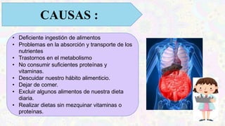 CAUSAS :
• Deficiente ingestión de alimentos
• Problemas en la absorción y transporte de los
nutrientes
• Trastornos en el metabolismo
• No consumir suficientes proteínas y
vitaminas.
• Descuidar nuestro hábito alimenticio.
• Dejar de comer.
• Excluir algunos alimentos de nuestra dieta
diaria.
• Realizar dietas sin mezquinar vitaminas o
proteínas.
 