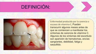 Enfermedad producida por la carencia o
escasez de vitamina C, Pueden
transcurrir algunos meses antes de
que se comiencen a manifestar los
síntomas de carencia de vitamina C.
Algunos de los síntomas del escorbuto
son aparición de hematomas, encías
sangrantes, debilidad, fatiga y
sarpullido.
DEFINICIÓN:
 