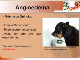 Angioedema
 Edema de Quincke:
● Edema Circunscrito;
● Pode ocorrer no panículo;
● Pode ser fatal em vias
respiratórias.
*Vacinas, Quimioterápicos,
Antibióticos.
http://veterinaria-online.blogspot.com.br/2009/05/caso-
clinico-1109-angioedema-facial-e.html
 