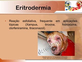 Eritrodermia
• Reação esfoliativa, frequente em aplicações
tópicas (Xampus, tiroxina, hidroxizina,
clorfeniramina, Itraconazol).
Erupção pigmentar fixa causada por Antifúngicos .
Fonte: http://dermatopet.com.br/micose-fungos/
 
