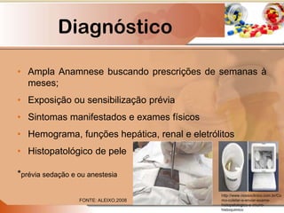 Diagnóstico
• Ampla Anamnese buscando prescrições de semanas à
meses;
• Exposição ou sensibilização prévia
• Sintomas manifestados e exames físicos
• Hemograma, funções hepática, renal e eletrólitos
• Histopatológico de pele
*prévia sedação e ou anestesia
FONTE: ALEIXO,2008
http://www.nossoclinico.com.br/Co
mo-coletar-e-enviar-exame-
histopatologico-e-imuno-
histoquimico
 