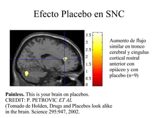 Efecto Placebo en SNC Painless.  This is your brain on placebos.  CREDIT: P. PETROVIC  ET AL (Tomado de Holden, Drugs and Placebos look alike in the brain. Science 295:947, 2002. Aumento de flujo similar en tronco cerebral y cingulus cortical rostral anterior con opiáceo y con placebo (n=9) 