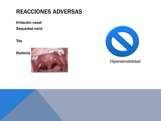 REACCIONES ADVERSAS
Irritación nasal
Sequedad nariz


Tos


Disfonía

                      Hipersensibilidad
 