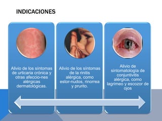 INDICACIONES




                                                         Alivio de
Alivio de los síntomas   Alivio de los síntomas
                                                    sintomatología de
de urticaria crónica y         de la rinitis
                                                        conjuntivitis
   otras afeccio-nes         alérgica, como
                                                      alérgica, como
       alérgicas         estor-nudos, rinorrea
                                                  lagrimeo y escozor de
    dermatológicas.             y prurito.
                                                            ojos
 