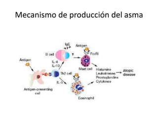 Mecanismo de producción del asma