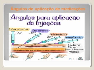 Ângulos de aplicação de medicações
 
