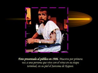 Foto presentada al público en 1986.  Muestra por primera vez a una persona que vive con el virus en su etapa terminal, en su piel el Sarcoma de Kaposi. 