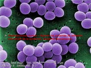 Staphylococcus aureus – digieren las proteínas de adhesión
intercelular de la epidermis, causando descamación.

 