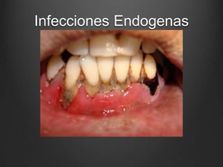 Infecciones Endogenas

 