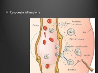 Respuesta inflamatoria

 