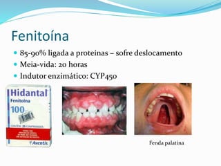 Fenitoína
 85-90% ligada a proteínas – sofre deslocamento
 Meia-vida: 20 horas
 Indutor enzimático: CYP450
Fenda palatina
 