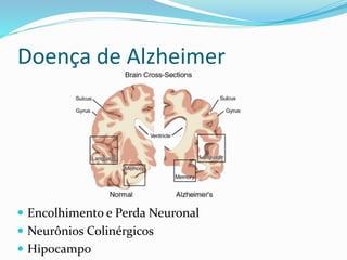Doença de Alzheimer
 Encolhimento e Perda Neuronal
 Neurônios Colinérgicos
 Hipocampo
 