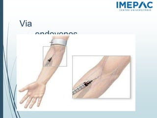 Via
endovenos
a
 