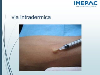 via intradermica
 