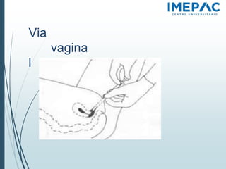 Via
vagina
l
 