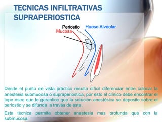 TECNICAS INFILTRATIVAS
    SUPRAPERIOSTICA
                            Periostio   Hueso Alveolar
                          Mucosa




Desde el punto de vista práctico resulta difícil diferenciar entre colocar la
anestesia submucosa o supraperiostica, por esto el clínico debe encontrar el
tope óseo que le garantice que la solución anestésica se deposite sobre el
periostio y se difunda a través de este.
Esta técnica permite obtener anestesia mas profunda que con la
submucosa.
 