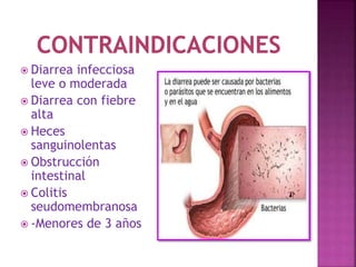  Diarrea infecciosa
leve o moderada
 Diarrea con fiebre
alta
 Heces
sanguinolentas
 Obstrucción
intestinal
 Colitis
seudomembranosa
 -Menores de 3 años
 