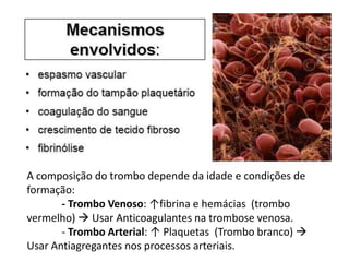 A composição do trombo depende da idade e condições de
formação:
       - Trombo Venoso: ↑fibrina e hemácias (trombo
vermelho)  Usar Anticoagulantes na trombose venosa.
       - Trombo Arterial: ↑ Plaquetas (Trombo branco) 
Usar Antiagregantes nos processos arteriais.
 