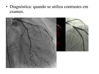 • Diagnóstica: quando se utiliza contrastes em
exames.
 