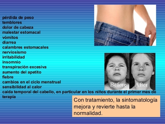 La caída familiar de los cabello