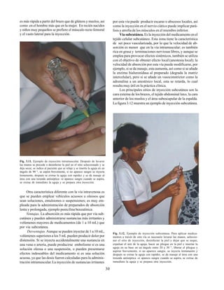 30
es más rápida a partir del brazo que de glúteos y muslos, así
como en el hombre más que en la mujer. En recién nacidos
y niños muy pequeños se prefiere el músculo recto femoral
y el vasto lateral para la inyección.
Fig. 3.11. Ejemplo de inyección intramuscular. Después de lavarse
las manos se procede a desinfectar la piel en el sitio seleccionado y se
deja secar, se indica al paciente que se relaje y se inserta la aguja en un
ángulo de 90 °, se aspira brevemente, si no aparece sangre se inyecta
lentamente, después se extrae la aguja con rapidez y se da masaje al
área con una torunda antiséptica -si aparece sangre cuando se aspira,
se extrae de inmediato la aguja y se prepara otra inyección.
Otra característica diferente con la vía intravenosa es
que se pueden emplear vehículos acuosos u oleosos que
sean soluciones, emulsiones o suspensiones; es muy em-
pleada para la administración de preparados de absorción
lenta y prolongada, ejemplo penicilina benzatínica.
Ventajas. La absorción es más rápida que por vía sub-
cutánea y pueden administrarse sustancias más irritantes y
volúmenes mayores de medicamentos (de 1 a 10 mL) que
por vía subcutánea.
Desventajas.Aunque se pueden inyectar de 1 a 10 mL,
volúmenes superiores a los 5 mL pueden producir dolor por
distensión. Si se inyecta accidentalmente una sustancia en
una vena o arteria, puede producirse embolismo si es una
solución oleosa o una suspensión, o pueden presentarse
efectos indeseables del medicamento si es una solución
acuosa, ya que las dosis fueron calculadas para la adminis-
tración intramuscular. La inyección de sustancias irritantes
por esta vía puede producir escaras o abscesos locales, así
como la inyección en el nervio ciático puede implicar pará-
lisis y atrofia de los músculos en el miembro inferior.
Vía subcutánea. Es la inyección del medicamento en el
tejido celular subcutáneo. Esta zona tiene la característica
de ser poco vascularizada, por lo que la velocidad de ab-
sorción es menor que en la vía intramuscular; es también
rica en grasa y terminaciones nerviosas libres, y aunque se
emplea para provocar efectos sistémicos, también se utiliza
con el objetivo de obtener efecto local (anestesia local); la
velocidad de absorción por esta vía puede modificarse, por
ejemplo, si se da masaje, esta aumenta, así como si se añade
la enzima hialuronidasa al preparado (degrada la matriz
intercelular), pero si se añade un vasoconstrictor como la
adrenalina a un anestésico local, esta se retarda, lo cual
resulta muy útil en la práctica clínica.
Los principales sitios de inyección subcutánea son la
cara externa de losbrazos, el tejido abdominal laxo, la cara
anterior de los muslos y el área subescapular de la espalda.
La figura 3.12 muestra un ejemplo de inyección subcutánea.
Fig. 3.12. Ejemplo de inyección subcutánea. Para aplicar medica-
mentos a través de esta vía es necesario lavarse las manos, seleccio-
nar el sitio de inyección, desinfectar la piel y dejar que se seque,
expulsar el aire de la aguja, hacer un pliegue en la piel e insertar la
aguja en su base en un ángulo entre 20 y 30 °, liberar el pliegue y
aspirar brevemente, si no aparece sangre, se inyecta lentamente y
después se extrae la aguja con rapidez, se da masaje al área con una
torunda antiséptica -si aparece sangre cuando se aspira, se extrae de
inmediato la aguja y se prepara otra inyección.
 