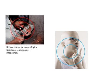 Reduce respuesta inmunologica
facilita presentacion de
infecicones.
 