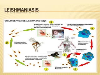 LEISHMANIASIS

 
