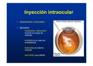 Inyección intraocular
ƒ Intracameral o intravítrea
ƒ Ejemplos:
Acetilcolina / cefuroxima
durante la cirugía de
catarata
Antibióticos en caso de
endoftalmitis
Esteroides en edema
macular
Anti-VEGF para DMAE
 