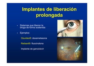 Implantes de liberación
prolongada
ƒ Sistemas que liberan la
droga de forma sostenida
ƒ Ejemplos:
Ozurdex®: dexametasona
Retisert®: fluocinolona
Implante de ganciclovir
 