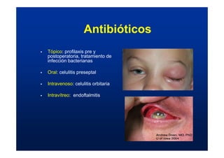 Antibióticos
ƒ Tópico: profilaxis pre y
postoperatoria, tratamiento de
infección bacterianas
ƒ Oral: celulitis preseptal
ƒ Intravenoso: celulitis orbitaria
ƒ Intravítreo: endoftalmitis
 