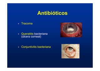 ƒ Tracoma
ƒ Queratitis bacteriana
(úlcera corneal)
ƒ Conjuntivitis bacteriana
Antibióticos
 