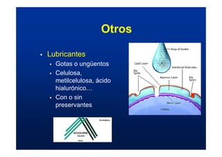 Otros
ƒ Lubricantes
ƒ Gotas o ungüentos
ƒ Celulosa,
metilcelulosa, ácido
hialurónico…
ƒ Con o sin
preservantes
 