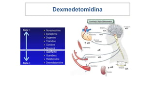 Dexmedetomidina
 