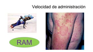 Velocidad de administración
RAM
 