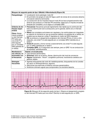 © 2006 Edición original en inglés: American Heart Association
© 2008 Edición en español: American Heart Association 46
Bloqueo de segundo grado de tipo I (Mobitz I–Wenckebach) (Figura 24)
Fisiopatología • Localización de la patología: nodo AV
• El suministro de sangre al nodo AV llega a partir de ramas de la coronaria derecha
(circulación derecha dominante)
• La conducción de los impulsos hacia el nodo AV se hace progresivamente más
lenta (lo que produce un intervalo PR creciente), hasta que un impulso sinusal se
bloquea por completo y no lo sigue un complejo QRS
Criterios de de-
finición según
el ECG
Clave: Alarga-
miento progresi-
vo del intervalo
PR hasta que
una onda P no
está seguida
por un complejo
QRS (pérdida de
un latido)
• Frecuencia: frecuencia auricular ligeramente más rápida que la ventricular (de-
bido a la dis­minución de la conducción); por lo general, dentro de un intervalo
normal
• Ritmo: los complejos auriculares son regulares y los ventriculares son irregulares
en relación al momento en que se producen (debido a la pérdida de un latido); es
posible que se observen ondas P regulares en medio de QRS irregulares
• PR: se produce un alargamiento progresivo del intervalo PR de un ciclo a otro;
después, una onda P no está seguida por un complejo QRS (“pérdida de un
latido”)
• Ondas P: tamaño y forma normal; ocasionalmente una onda P no está seguida
por un QRS (“pérdida de un latido”)
• Complejo QRS: ≤0,10 segundos casi siempre, pero un QRS “no se conduce (no
se expresa)” periódicamente
Manifestacio-
nes clínicas, re­
lacionadas con
la frecuen­cia
Debido a la bradicardia:
• Casi siempre asintomática
• Síntomas: dolor en el pecho, disnea, disminución del nivel de conciencia
• Signos: hipotensión, “shock”, congestión pulmonar, insuficiencia cardiaca con-
gestiva, angina
Etiologías
frecuentes
• Agentes bloqueantes del nodo AV: betabloqueantes, bloqueantes de los canales
de calcio no dihidropiridínicos, digoxina
• Afecciones que estimulan el sistema nervioso parasimpático
• Síndrome coronario agudo que compromete a la coronaria derecha
Figura 24. Bloqueo AV de segundo grado de tipo I. Observe el alargamiento progresi-
vo del intervalo PR hasta que una onda P (flecha) no está seguida por un QRS.
 