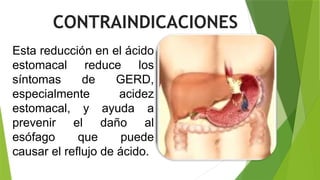 Esta reducción en el ácido
estomacal reduce los
síntomas de GERD,
especialmente acidez
estomacal, y ayuda a
prevenir el daño al
esófago que puede
causar el reflujo de ácido.
CONTRAINDICACIONES
 