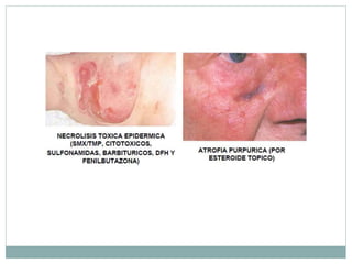 FARMACOVIGILANCIA Y RAM.ppt